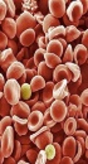 Safety and Efficacy of Direct-Acting Antivirals in Transfusion-Dependent Thalassemic Patients with Chronic Hepatitis C